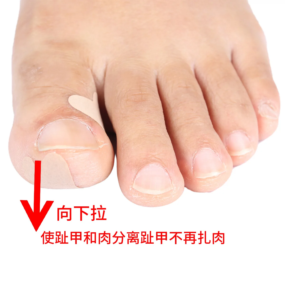 Стикер за корекция вросшего на нокътя на крака, залепваща тампон за ноктите на краката си, еластична стикер за корекция на ноктите, средства за грижа за краката 내성발톱