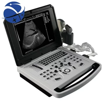 Лаптоп за бременни, черно-бял портативен ултразвуков скенер за бременни, Цена